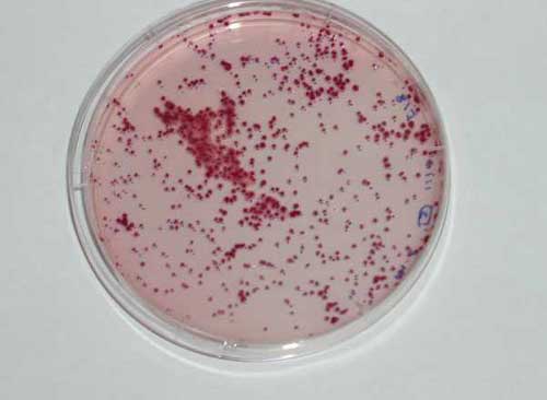Photo of faecal streptococci bacteria