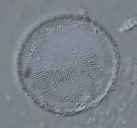 photo of Thalassiosira lacustris: a common brackish water estuarine diatom